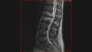 Schnittbilddiagnostik der Wirbelsäule (1.13)