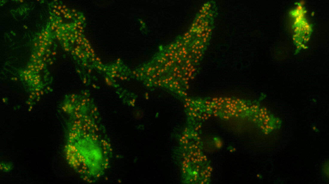 Acinetobacter_baumannii-Bakterien.jpg Kultivierte Acinetobacter baumannii-Bakterien leben jedoch in einer Art Tiefschlaf weiter