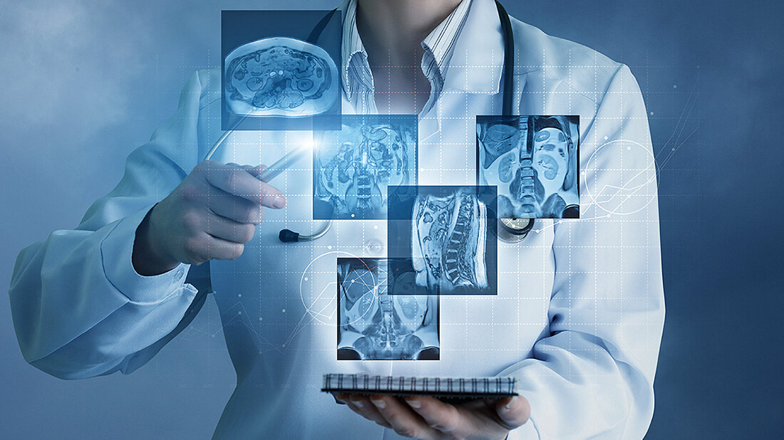 Grafik mit einer Collage aus radiologischen Aufnahmen