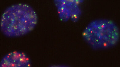 BRCA1 bei der Arbeit