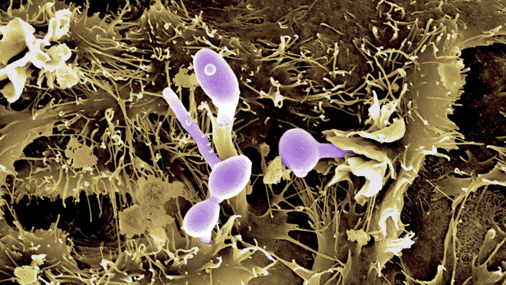 Candida albicans 