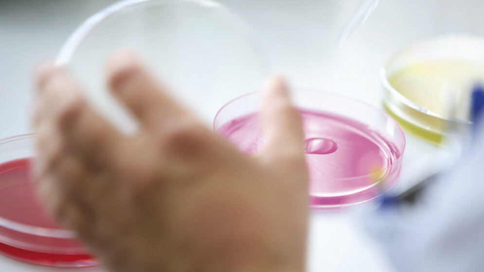 Verordnung zur Anpassung der Meldepflichten nach dem Infektionsschutzgesetz an die epidemische Lage IfSGMeldeAnpV