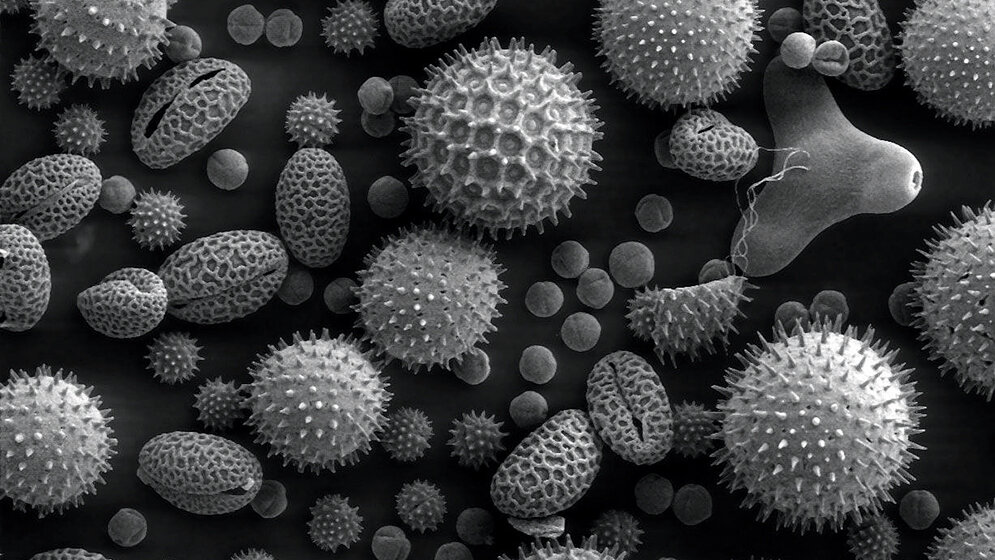 Laboratoriumsmedizin Allergologie