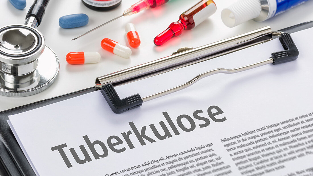 Tuberkulose