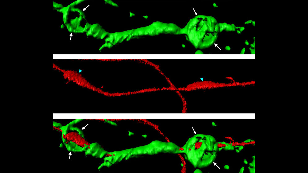 Aktin-Sphären, die ein geschnittenes Axon umgeben