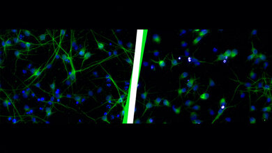 Gesunde_Neuronen_links_im_Vergleich_zu_Neuronen_nach_einer_Aktivierung_von_HERV_K__HML_2__HZM_Michelle_Vincendeau.jpg Gesunde Neuronen (links) im Vergleich zu Neuronen nach einer Aktivierung von HERV-K(HML-2) (rechts).