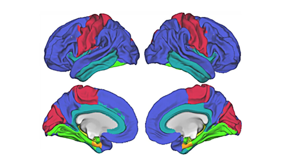Risikogen der Alzheimer Krankheit