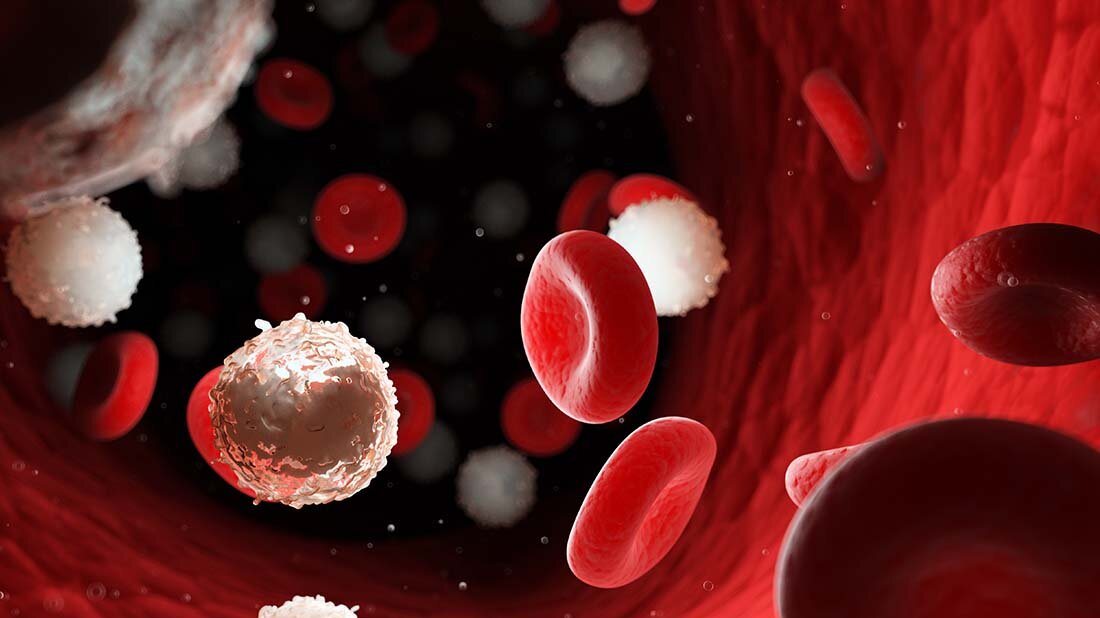 Leukaemie_online2.jpg Neue Leukämiediagnostik: Optische Genomkartierung