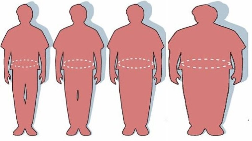 Obesity_Mike_Licht_CC_BY_2_01042016.jpg Adipositas