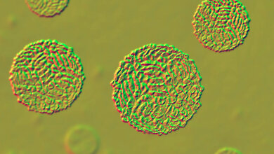 West_Nil_Virus.jpg West-Nil-Virus