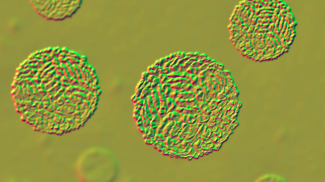 West_Nil_Virus.jpg West-Nil-Virus