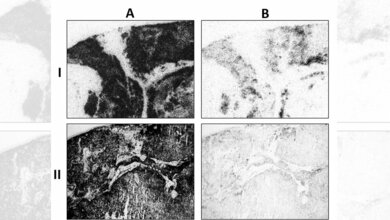 gemessene Menge an SST2-Rezeptoren 
