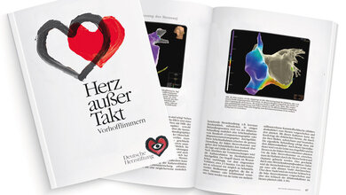 „Herz außer Takt: Vorhofflimmern“ 