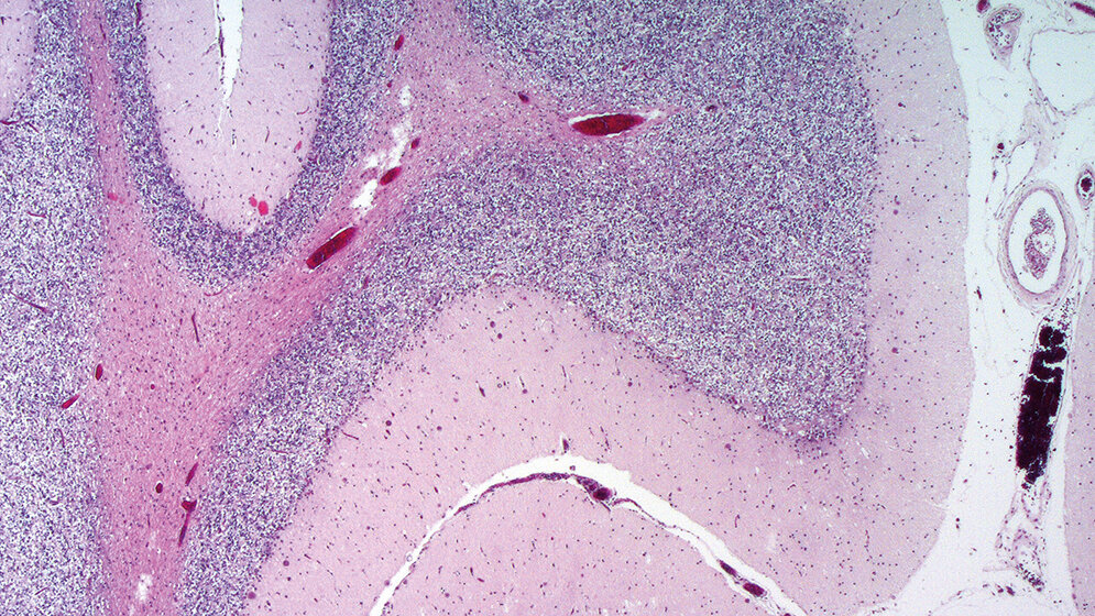 Laboratoriumsmedizin Immunhistochemie