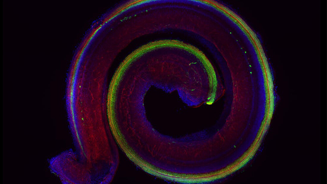 Gehoerschnecke.jpg Gehoerschnecke.jpg