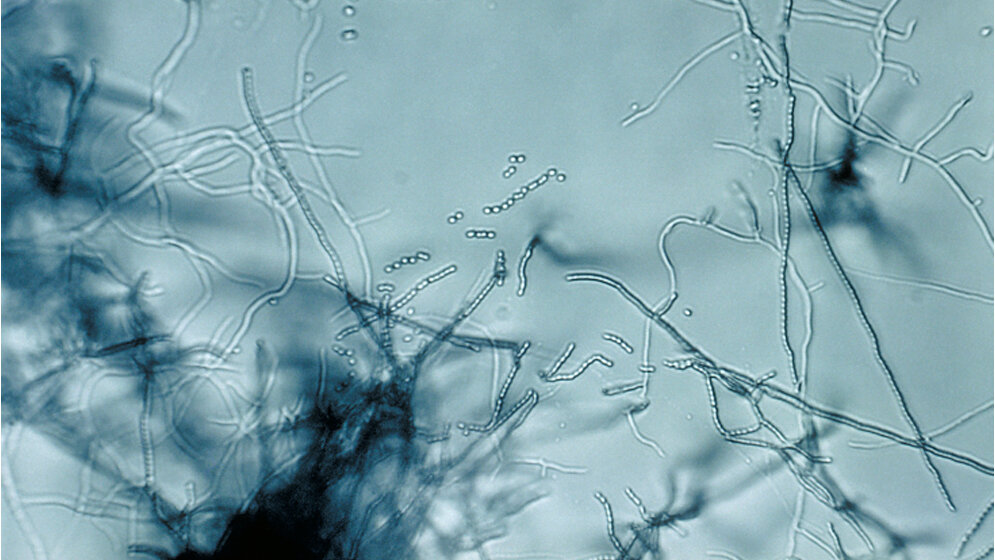 Streptomyces_sp_gemeinfrei.jpg Streptomyces sp.
