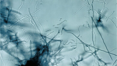 Streptomyces sp. 
