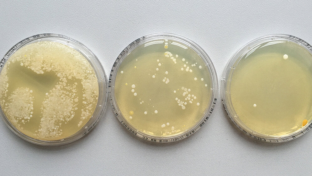 Dialog Hygieneprojekt Händehygiene