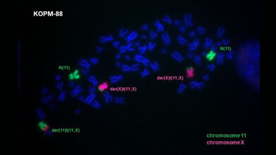 Fluoreszenz-Aufnahme der Chromosomen von Zelllinie KOPM-88.