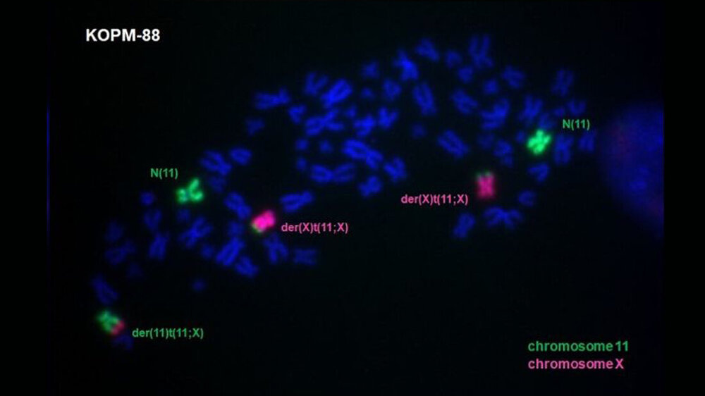 Fluoreszenz-Aufnahme der Chromosomen von Zelllinie KOPM-88.