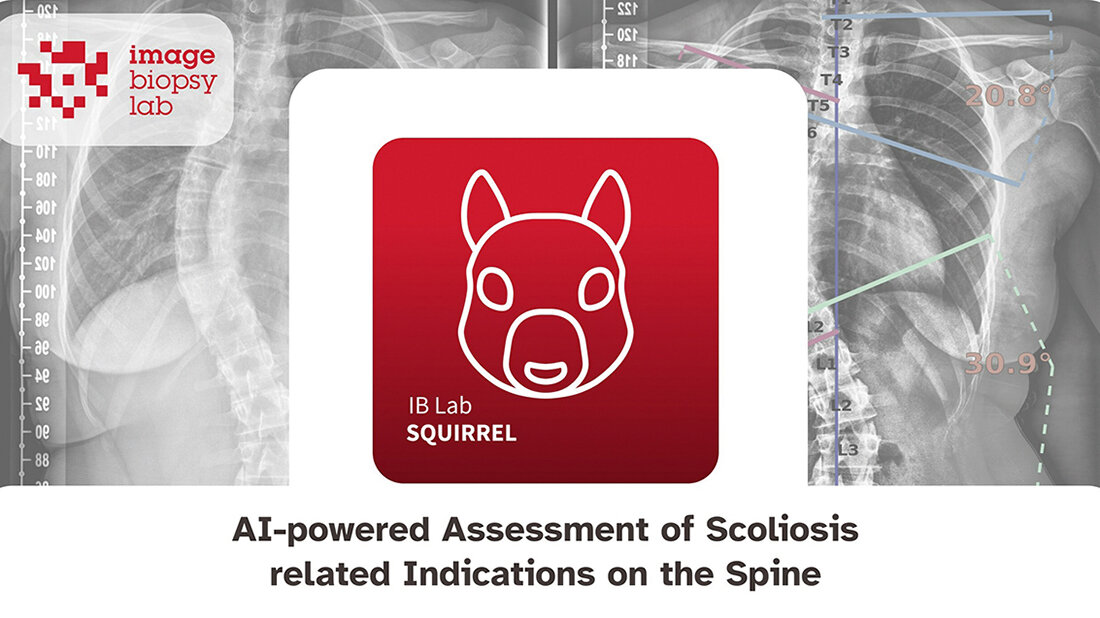 Titelbild zur Meldung über IB Lab SQUIRREL, die KI-gestützte Bildauswertung bei Skoliose
