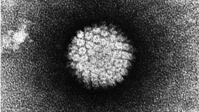 Elektronenmikroskopische_Aufnahme_eines_Humanen_Papillomvirus_Wikimedia_Commons.jpg Elektronenmikroskopische Aufnahme eines HPV