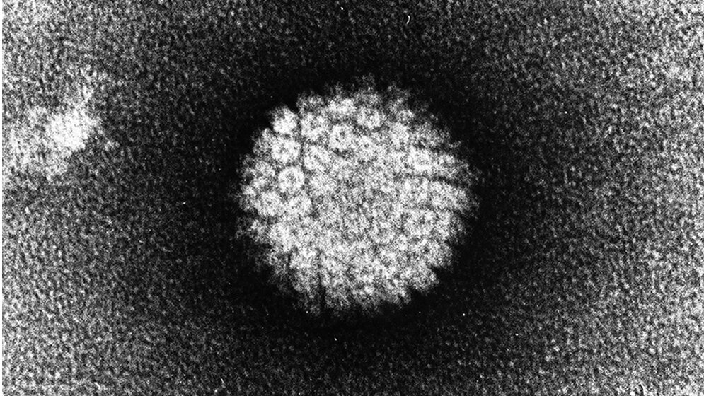 Elektronenmikroskopische_Aufnahme_eines_Humanen_Papillomvirus_Wikimedia_Commons.jpg Elektronenmikroskopische Aufnahme eines HPV