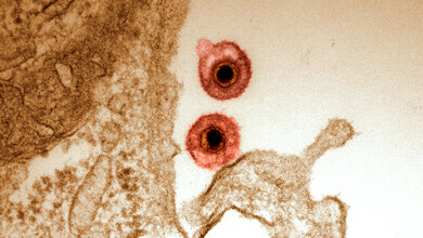 Herpesvirennewsimage281055.jpg Herpes