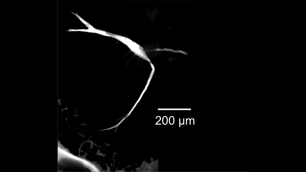 Mikroskopische_Aufnahme_der_Mauthnerzelle_eines_Goldfisches_Peter_Machnik.jpg Mikroskopische Aufnahme der Mauthnerzelle