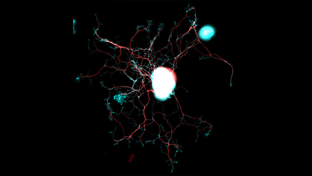 Nervenzelle_aus_den_dorsalen_Wurzelganglien_unter_dem_Mikroskop_DZNE_Barbara_Schaffran.jpg Nervenzelle