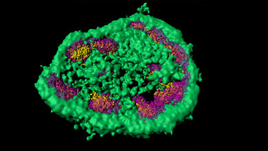 Nukleolus besteht aus verschiedenen membranlosen Zonen 