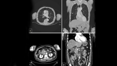 Polytrauma_CT_Nebenbefunde_der_Kategorie_1_Unfallkrankenhaus_Berlin_02052016.jpg CT Nebenbefunde