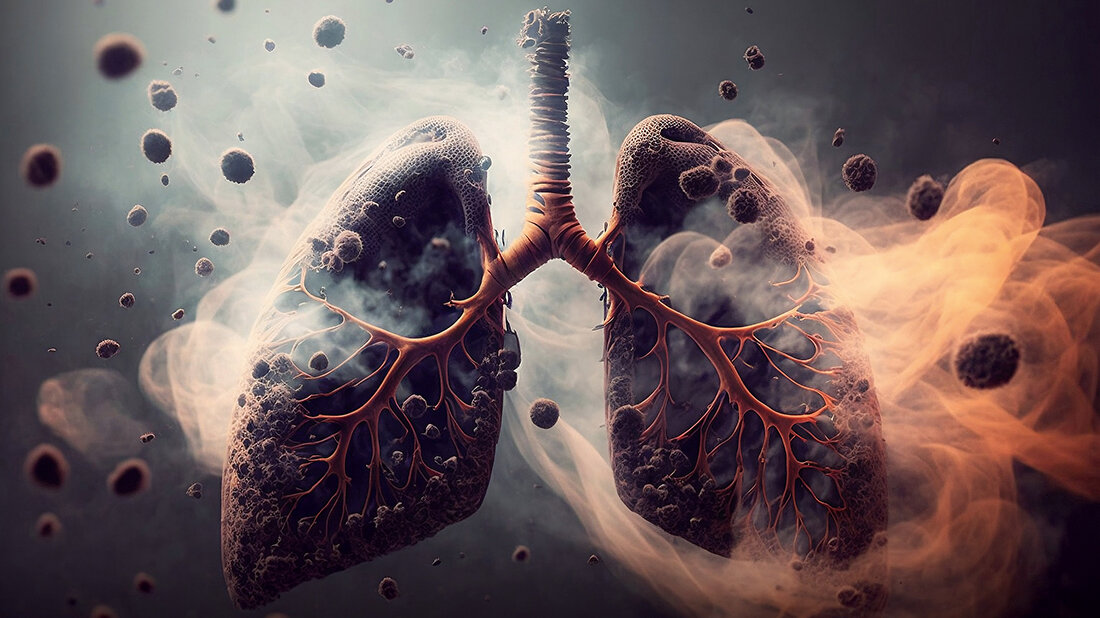 Titelbild des Fachbeitrags zu Gemeinsamkeiten und Unterschieden von COPD und Lungenemphysem