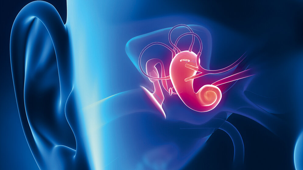 „Time is Brain“ aus Sicht der Funktionsdiagnostik