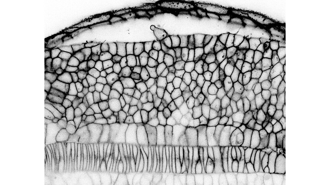 Zellen.jpg Tastsinn der Zellen