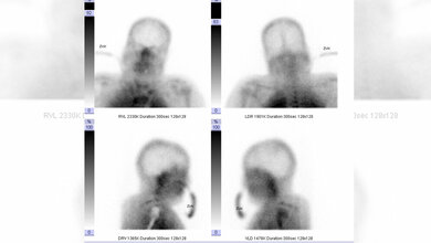 Fehlende Hirnperfusion 