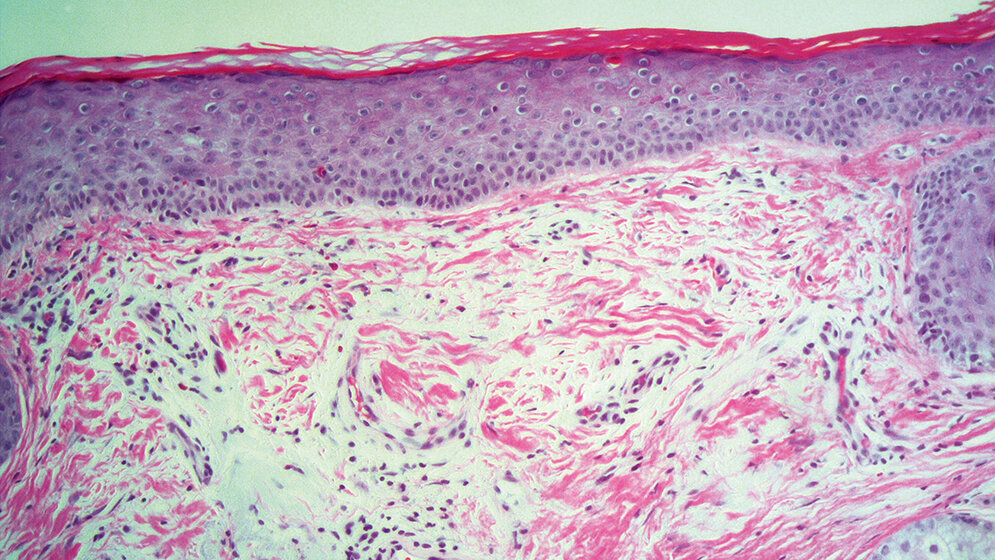 Histologie Immunhistochemie