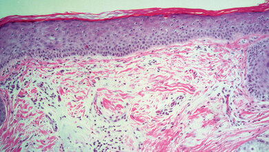 Histologie Immunhistochemie