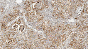 Optimierung und Validierung von PD-L1-Färbeprotokollen am Beispiel E1L3N (Teil 4)