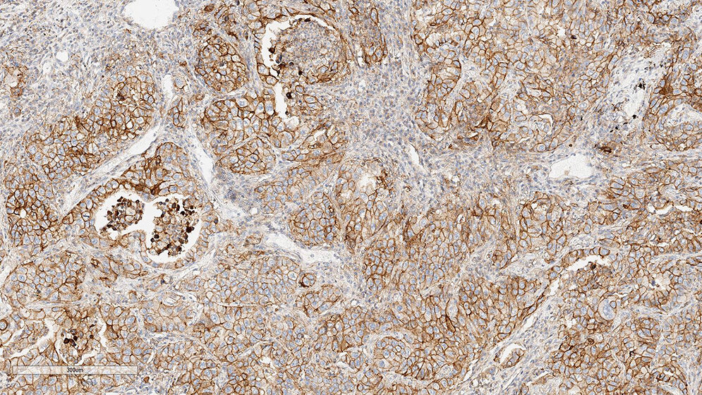Optimierung und Validierung von PD-L1-Färbeprotokollen am Beispiel E1L3N (Teil 4)