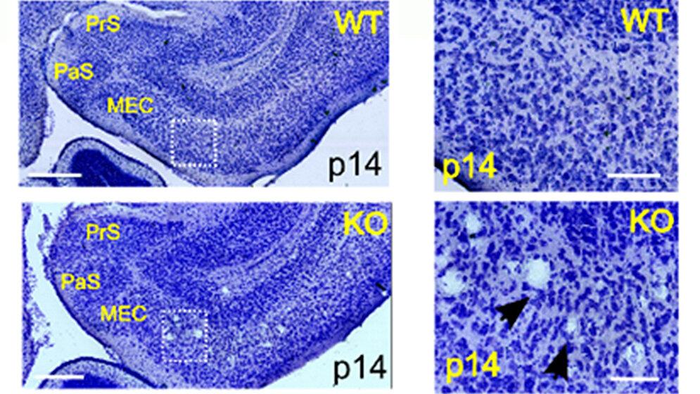 Neurodegenerative Veränderungen im Gehirn von Mäusen