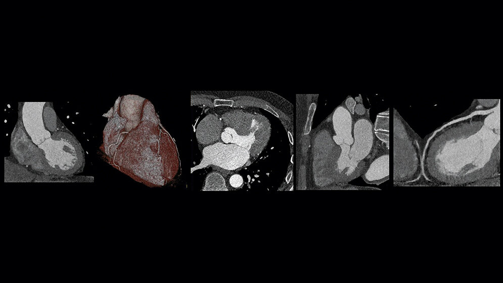 Faszination Herz-CT
