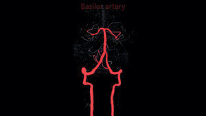 Regelrechte Darstellung der A. basilaris