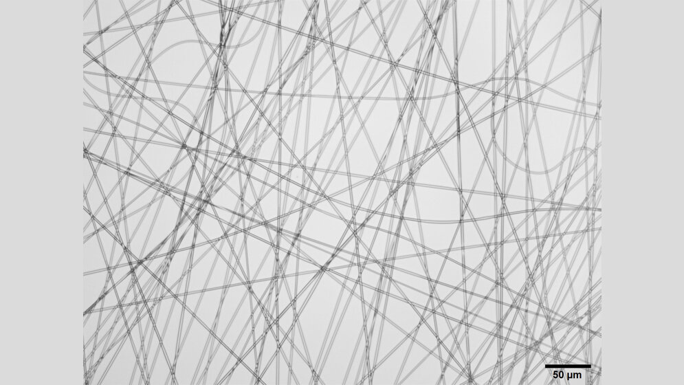 Lichtmikroskopische_Aufnahme_der_Nimodipinfasern_Johanna_Zech.jpg Lichtmikroskopische Aufnahme der Nimodipinfasern