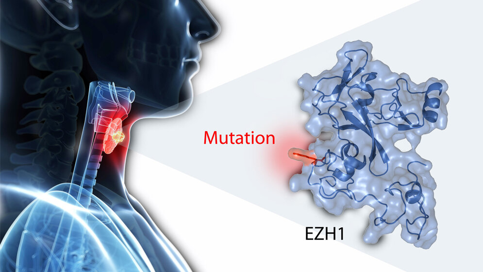 Mutation_in_EZH1_Gen_Uni_Wuerzburg_Davice_Calebiro_Kerstin_Bathon.jpg Mutation im EZH1-Gen
