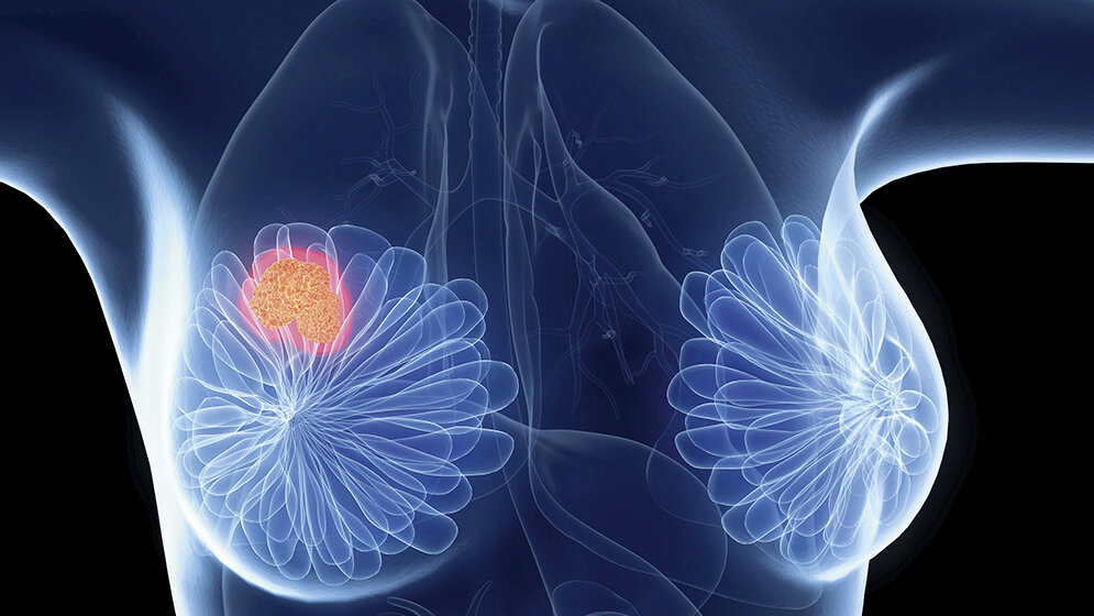 Genexpressionsanalysen (Teil 4.1)