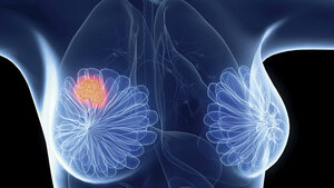 Genexpressionsanalysen (Teil 4.1)