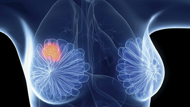 Genexpressionsanalysen (Teil 4.1)