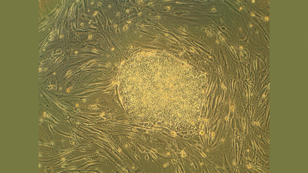 Embryonale Stammzellen