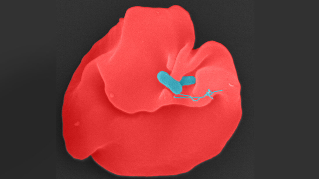 Bartonella_bacilliformis.jpg Bartonella bacilliformis infiziert einen menschlichen Erythrozyten.